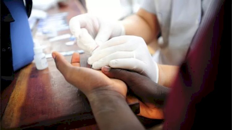 Combate ao HIV: por que redução nas infecções teve pior número desde 2016