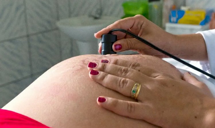 Assistência ao parto avança no Brasil, mas pré-natal ainda preocupa